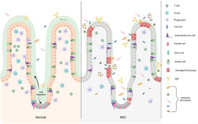 Paneth cell development in the neonatal gut: pathway regulation, development, and relevance to necrotizing enterocolitis